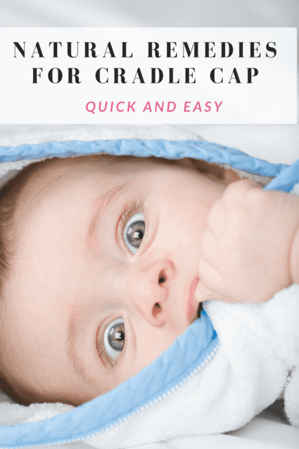 Natural Remedies for Cradle Cap (Quick & Easy) The CentsAble Shoppin