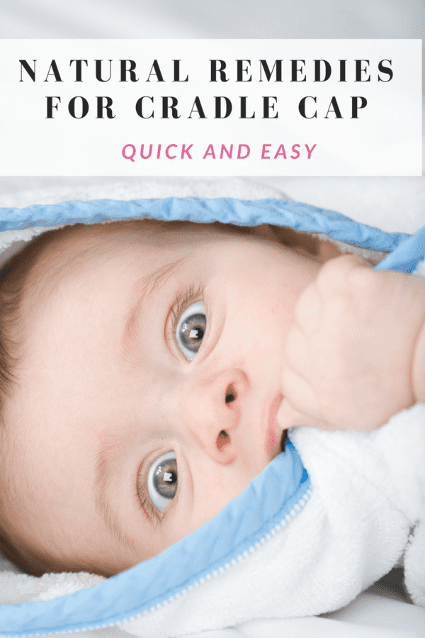 Natural Remedies For Cradle Cap Quick And Easy The Centsable Shoppin
