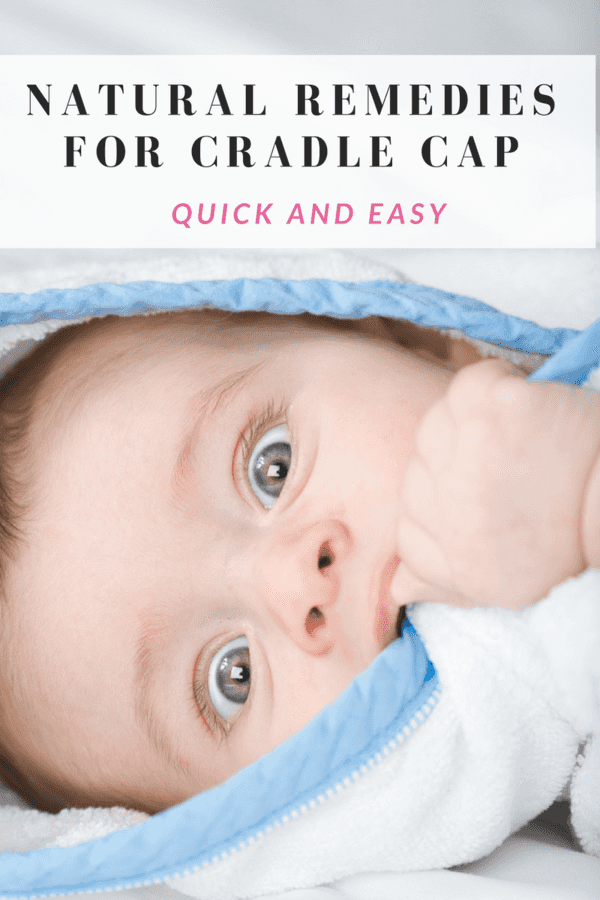 Natural Remedies for Cradle Cap (Quick & Easy)