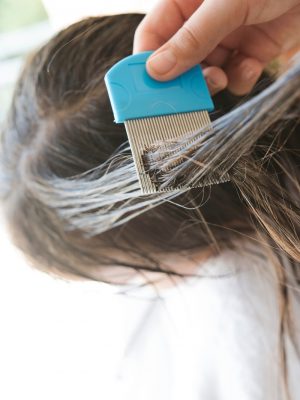 Natural Remedies for Head Lice